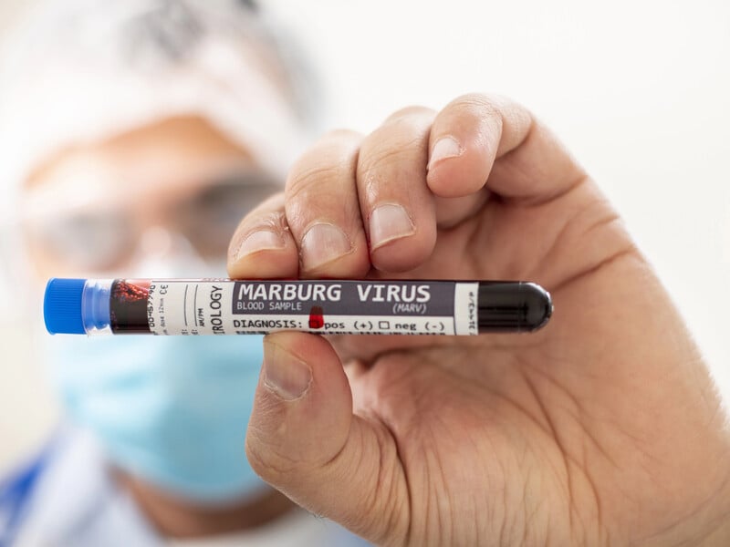 Ethiopia reports first cases of deadly Marburg virus