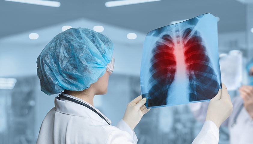 WHO: Global progress in TB fight threatened by funding shortfall