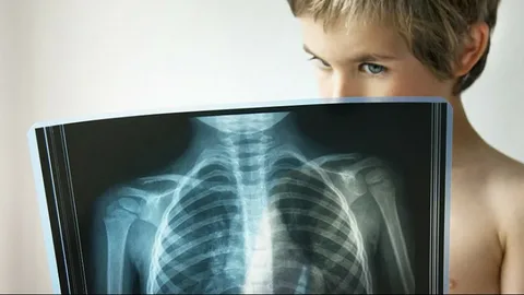 In the CIS, they plan to reduce tuberculosis incidence to 20% and mortality to 35%.