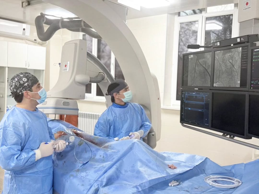 Recanalization of the iliac veins and inferior vena cava was performed for the first time in Tajikistan