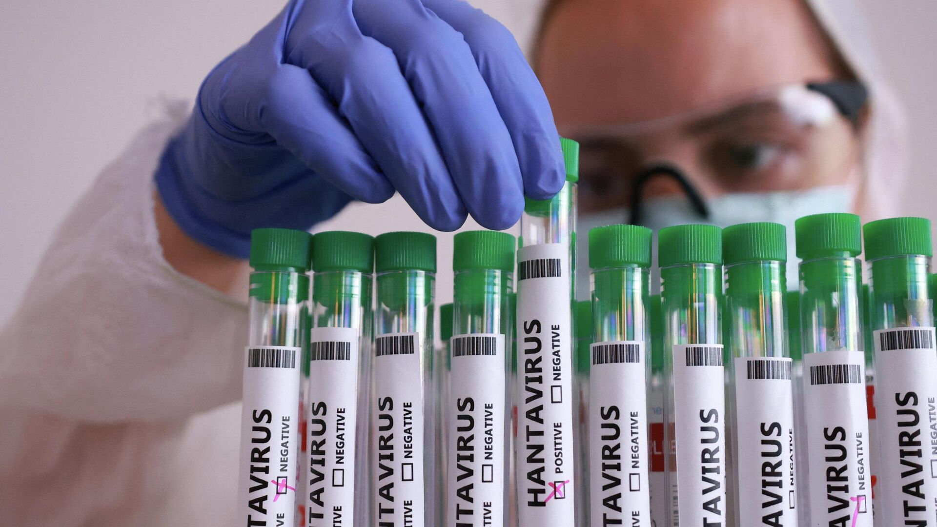 The Ministry of Health assessed the risk of hantavirus spread in Tajikistan.