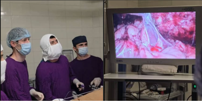 A rare kidney operation was performed in Dangara